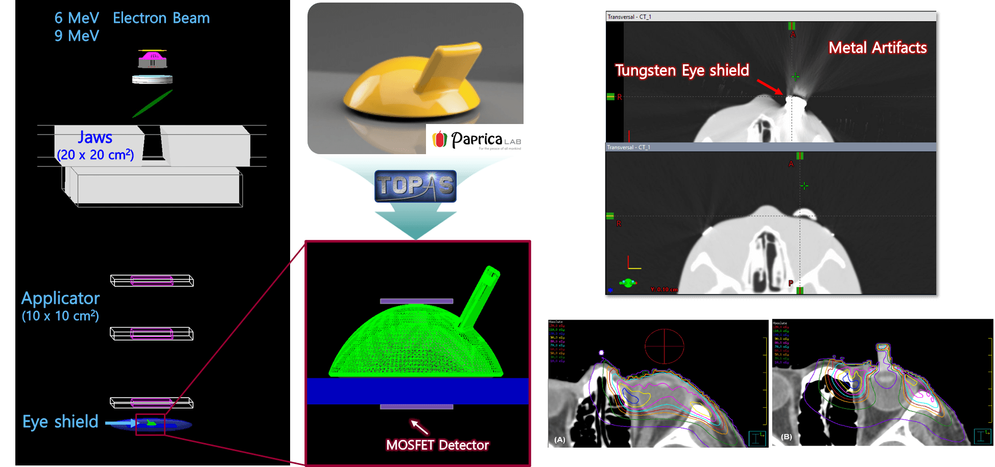 Eye Shield System for Radiation Therapy